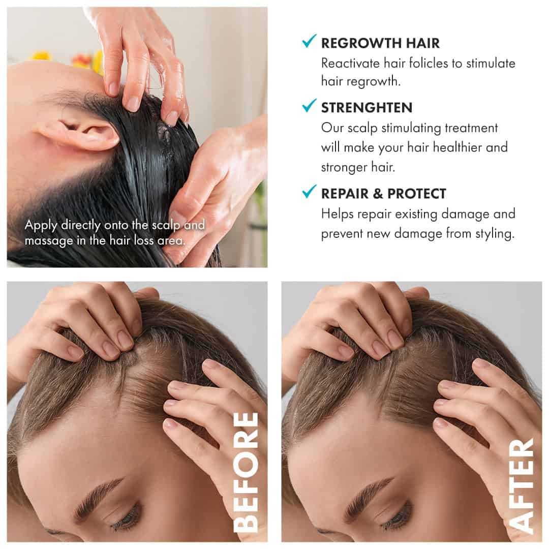 A person applies Diamond Botox Hair Repair Treatment (Ampule) to their scalp; before-and-after images show reduced hair thinning at the hairline. Text highlights benefits: regrowth, strengthening, repair, and hair protection.
